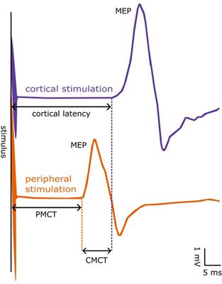 Sex-specific reference values for total, central, and peripheral latency of motor evoked potentials from a large cohort